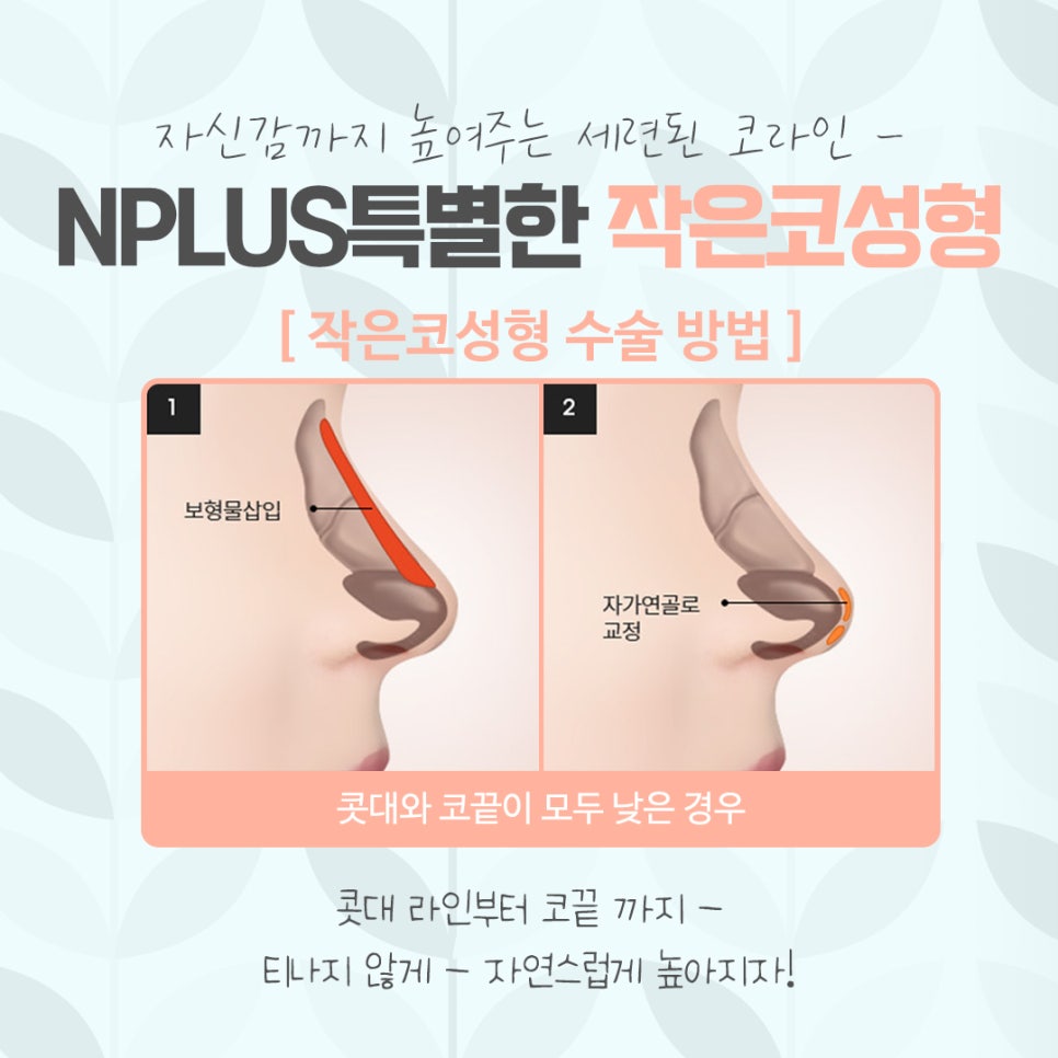 작은코수술을 통해 입체적인 라인으로 관련 이미지 8