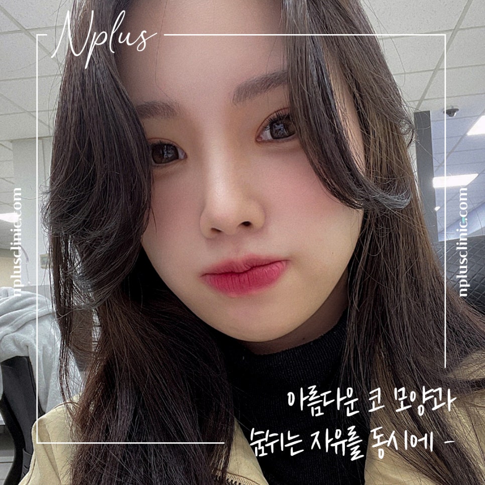콧볼축소후기 섬세하게 알아보고 관련 이미지 4