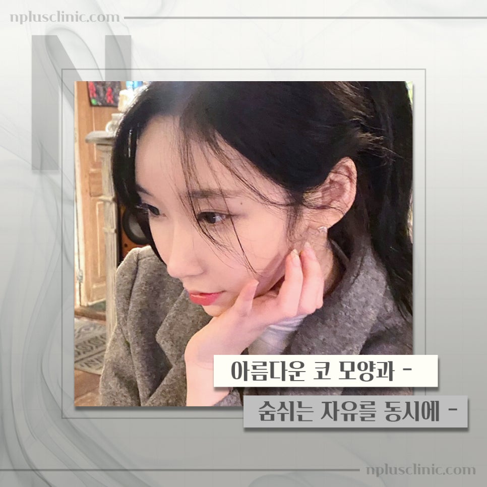 기능코성형실비에 대해 체크하고 관련 이미지 1