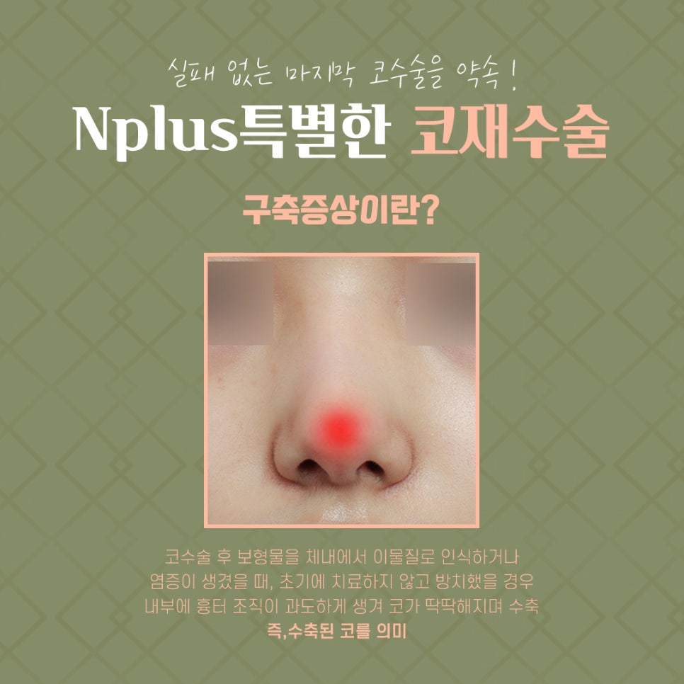 구축코수술후기 원인 파악을 확실하게 관련 이미지 5