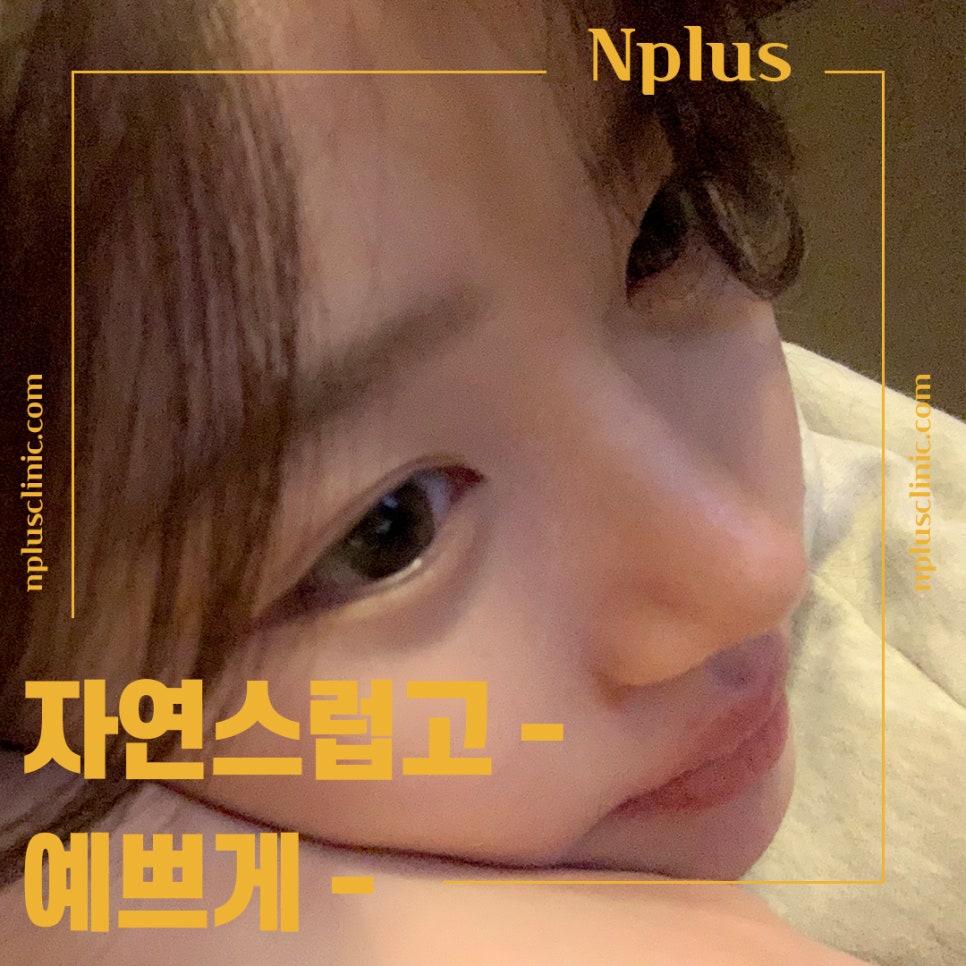 기능코성형후기 이미지를 고려하여 관련 이미지 6