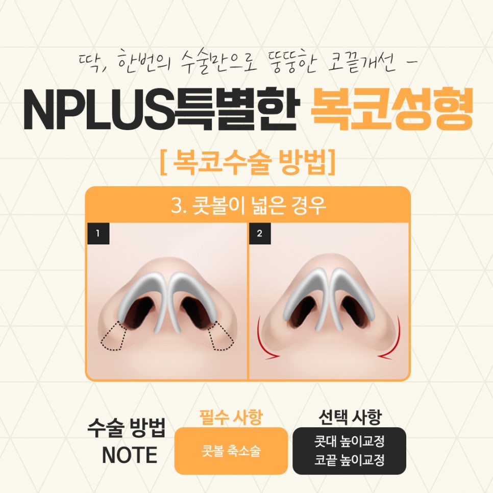 복코수술후기 정확한 진단을 통하여 관련 이미지 10