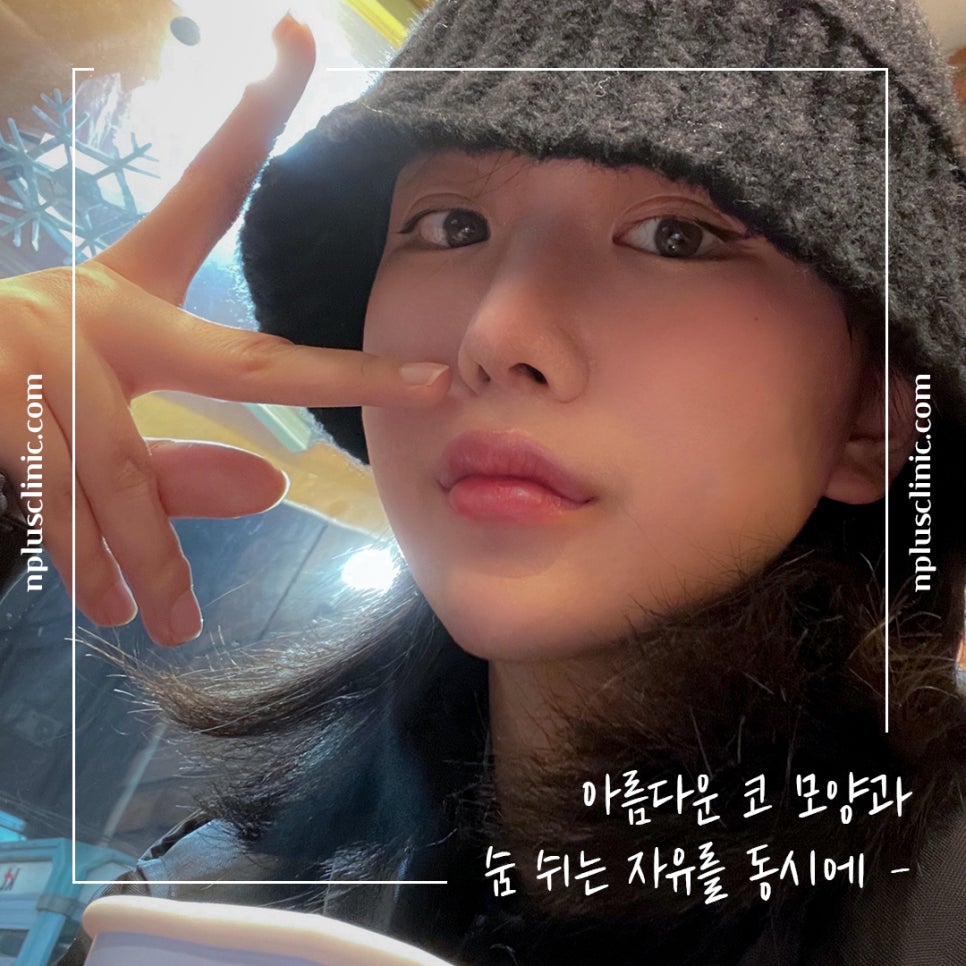 코수술전후 확실한 변화로 관련 이미지 2