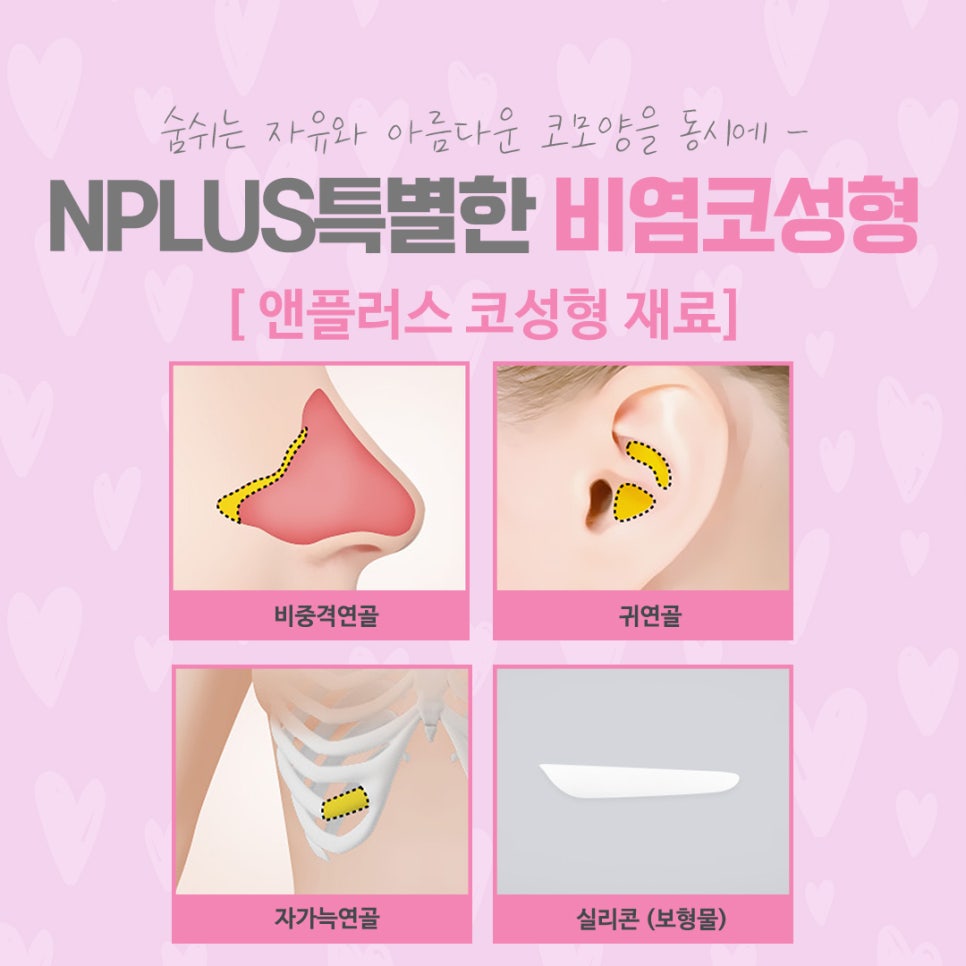 비염코수술 원인을 정확하게 파악하고 관련 이미지 9
