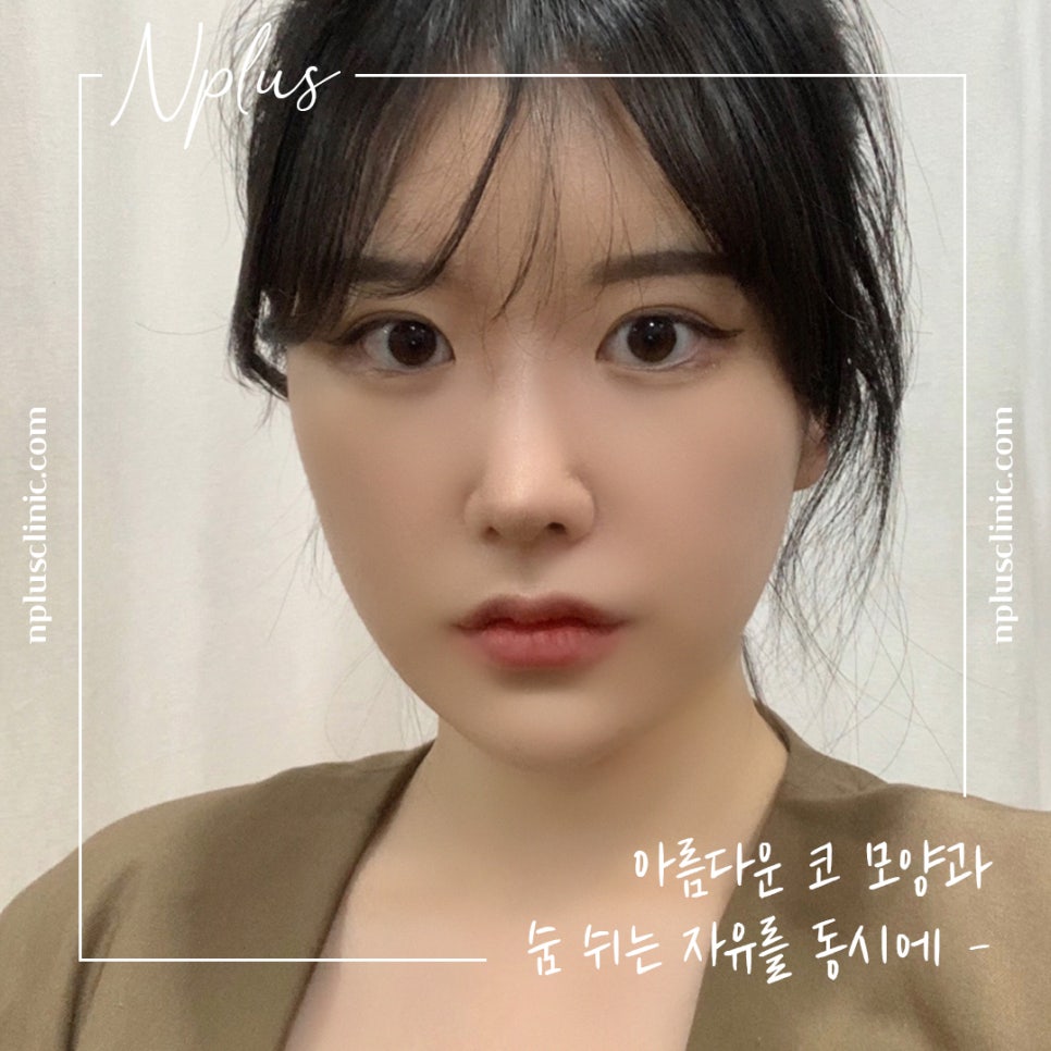 코수술후기 라인까지 고려해서 관련 이미지 3