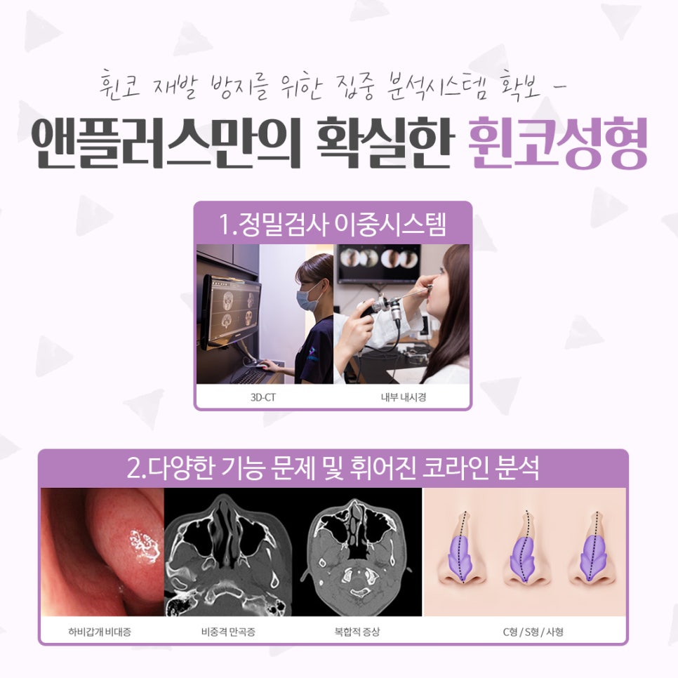 휜코성형후기 기능까지 확인해야 관련 이미지 7