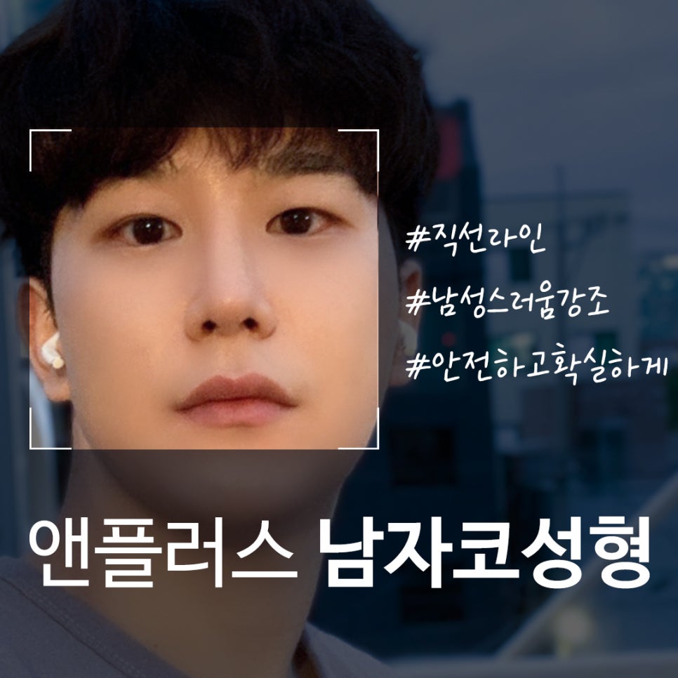 남자코성형후기 기능까지 추가하여 관련 이미지 2
