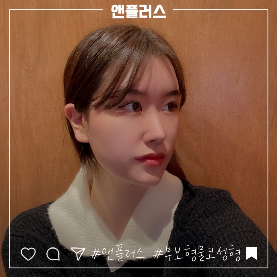 Accurately Check Non-Implant Rhinoplasty image 2