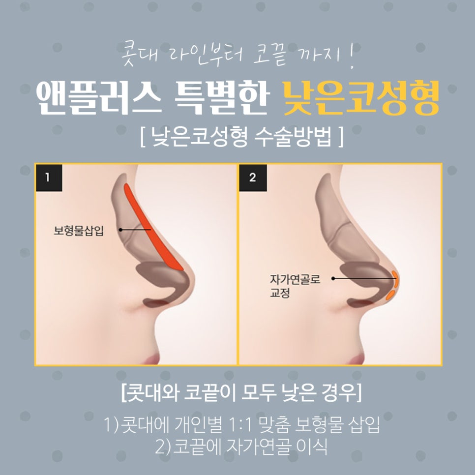 Transforming a Low Nose with a Beautiful Nose Line image 7