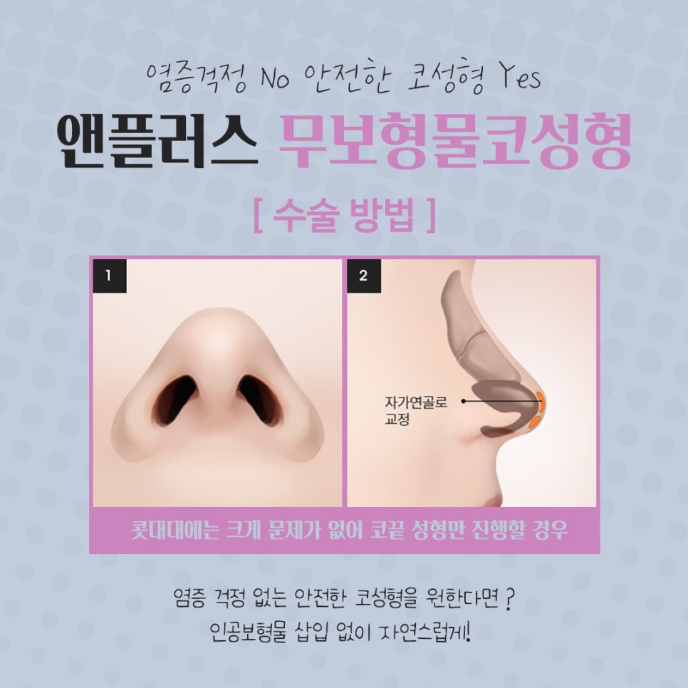 Deciding After Carefully Reviewing Non-Implant Rhinoplasty Reviews image 12