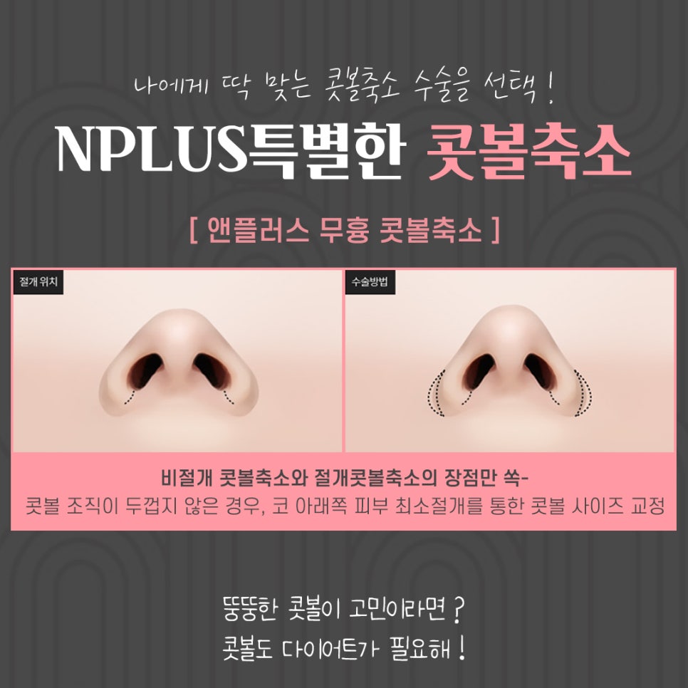 콧볼축소후기 확실하게 알아보고 관련 이미지 5