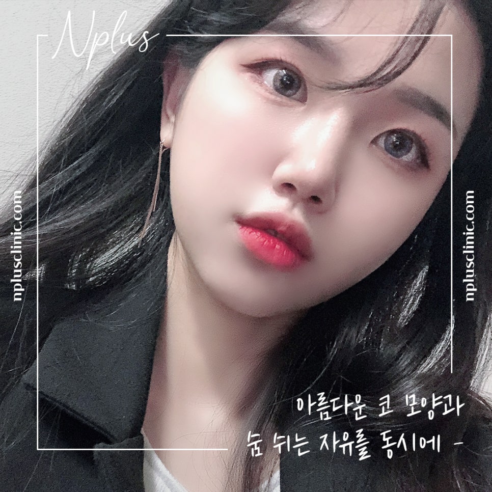 코성형전후 꼼꼼하게 비교하고 결정 관련 이미지 8