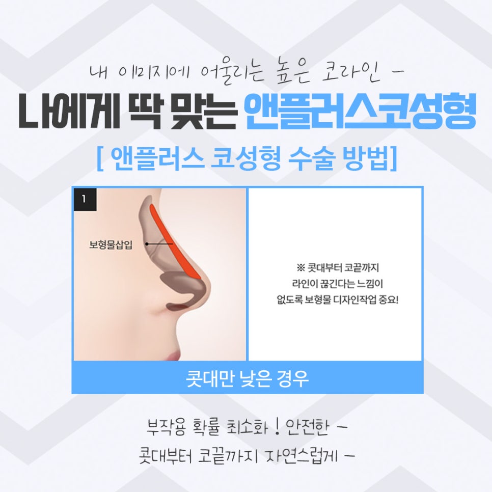 코성형후기를 다양하게 찾아보고 관련 이미지 9