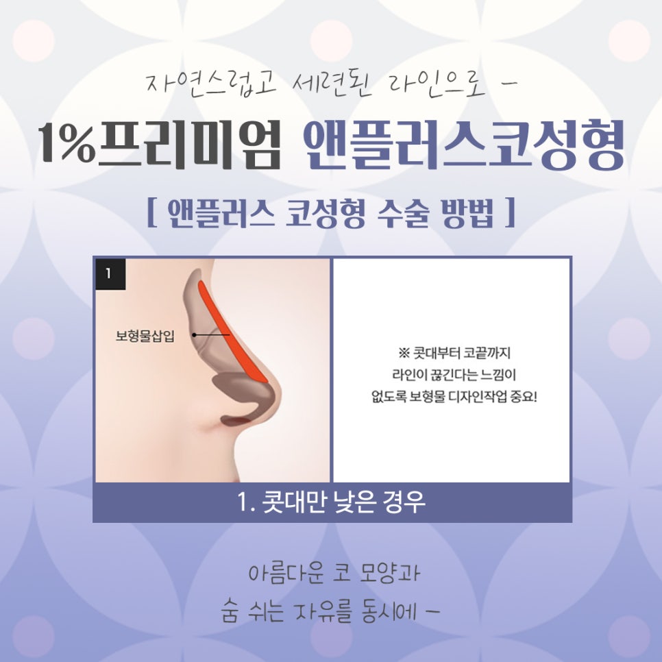 자가늑코수술 내게 어울리는 라인으로 관련 이미지 8