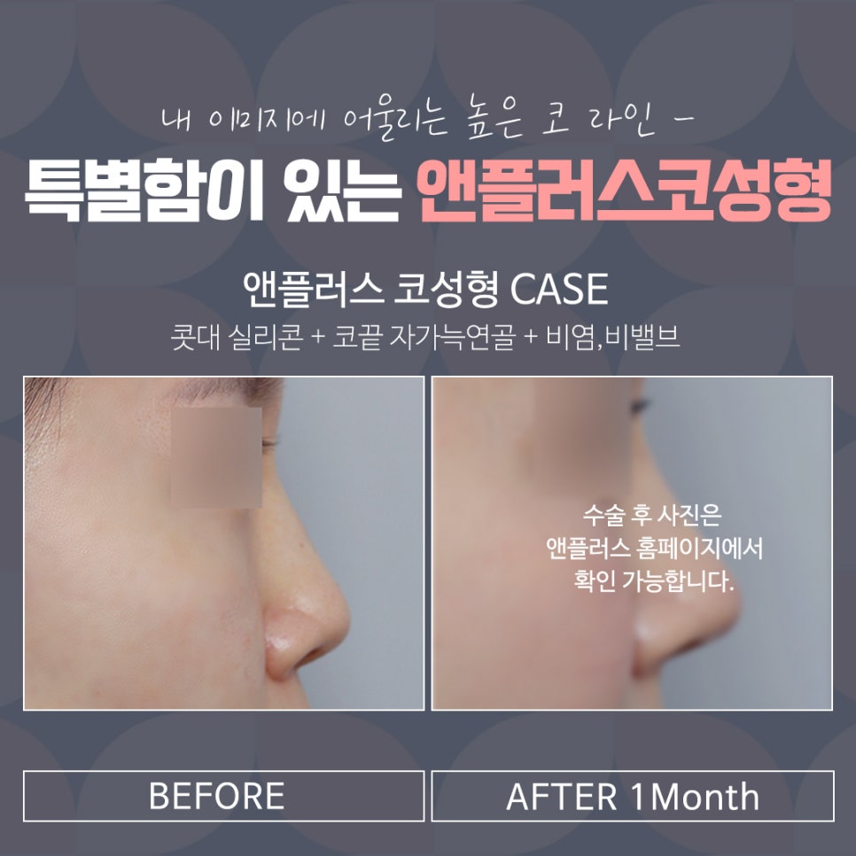직반버선코 자연스러운 라인으로 관련 이미지 18