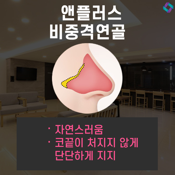 낮은코수술 자연스러운 앤플러스 관련 이미지 4