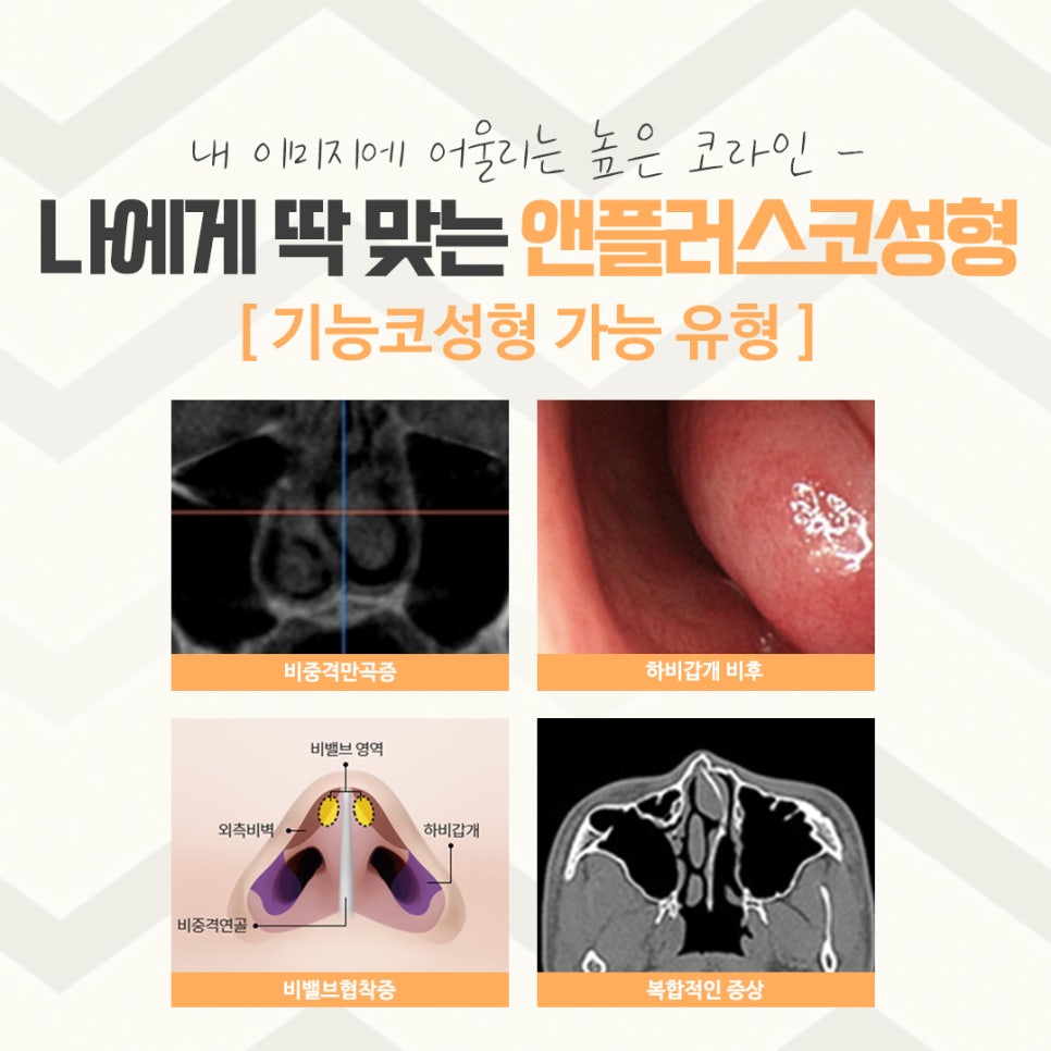 코수술후기에 대해 자세하게 알아보고 관련 이미지 6