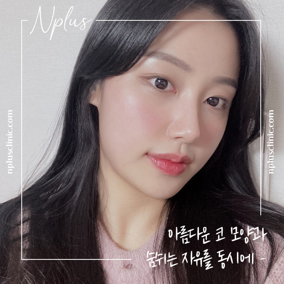 콧볼축소후기 원인을 정확하게 알아보고 관련 이미지 10