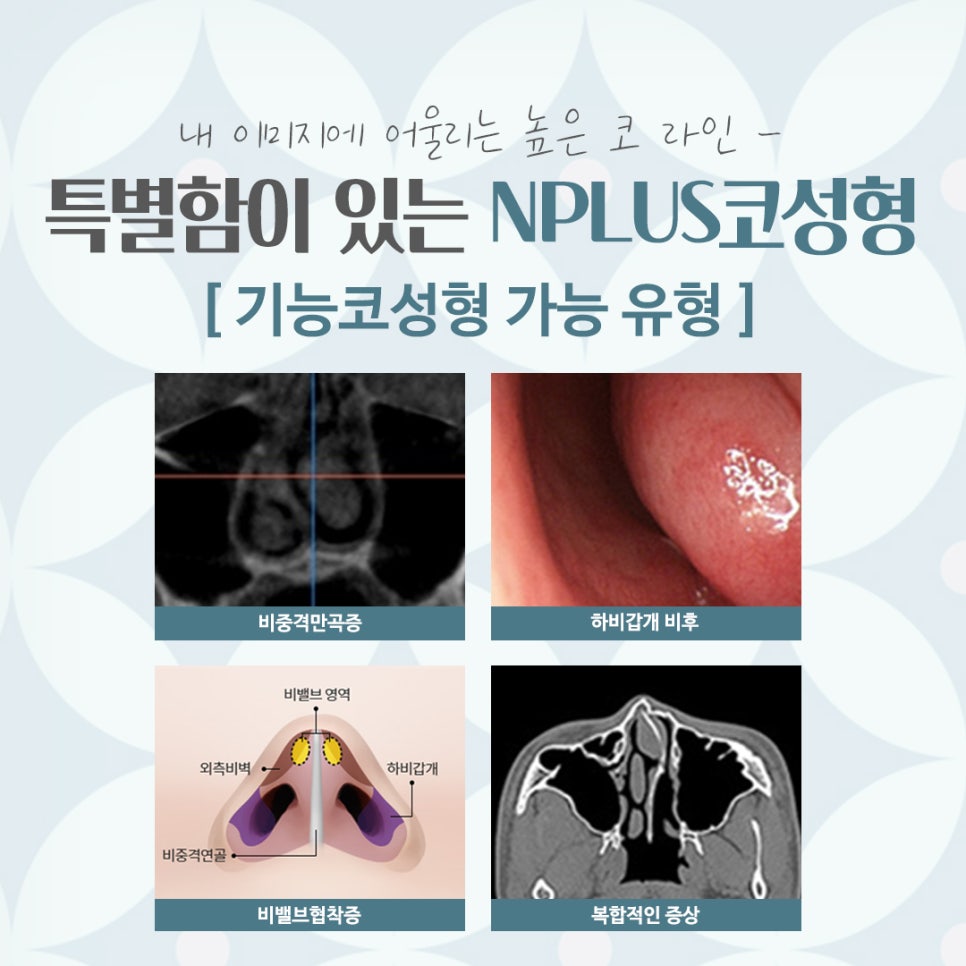 A Beautiful Nose Line at a Well-Known Seoul Plastic Surgery Clinic image 6