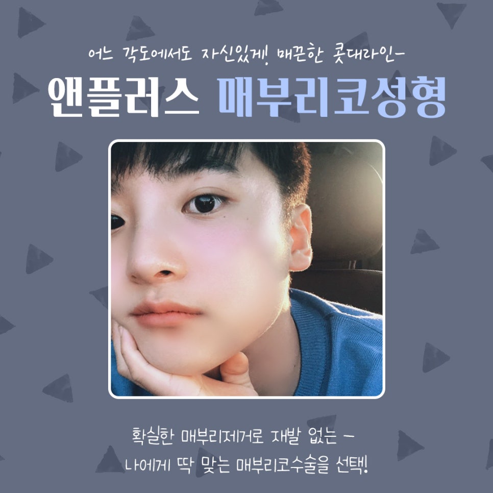 남자매부리코성형 기능까지 고려해서 관련 이미지 2