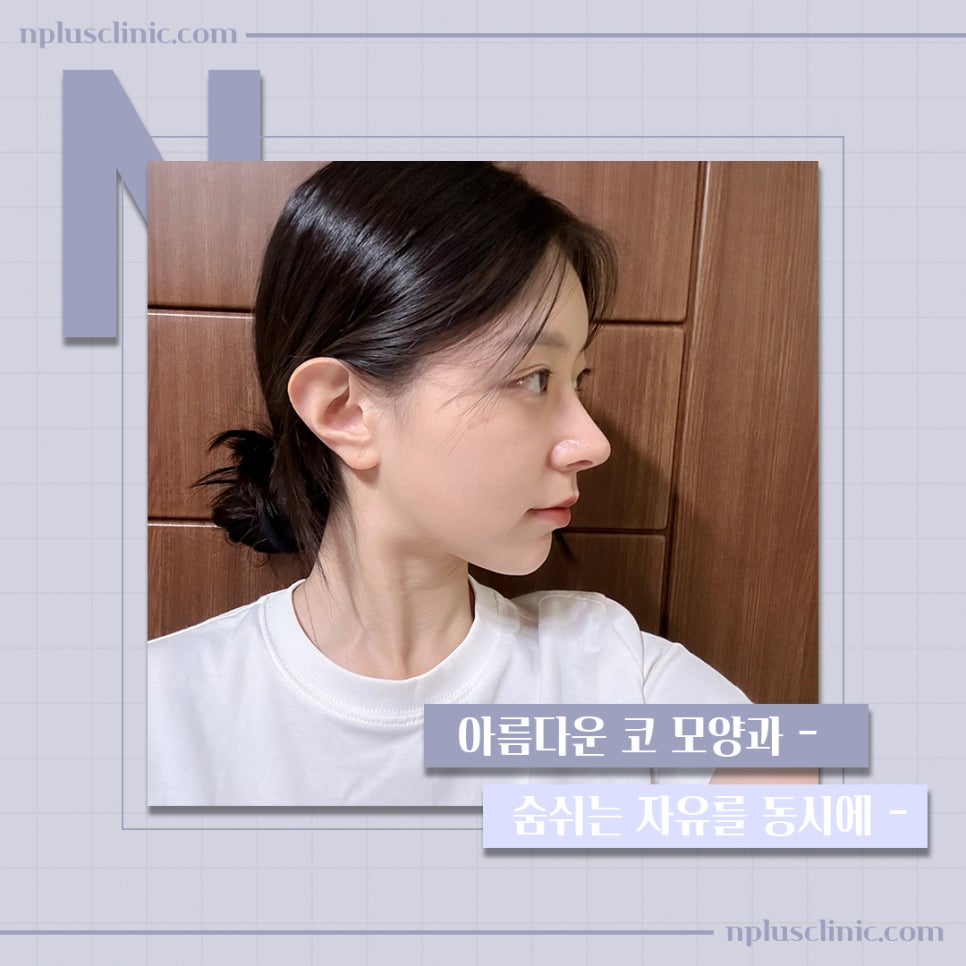Learn More About Functional Nose Surgery Medical Expense Coverage image 2