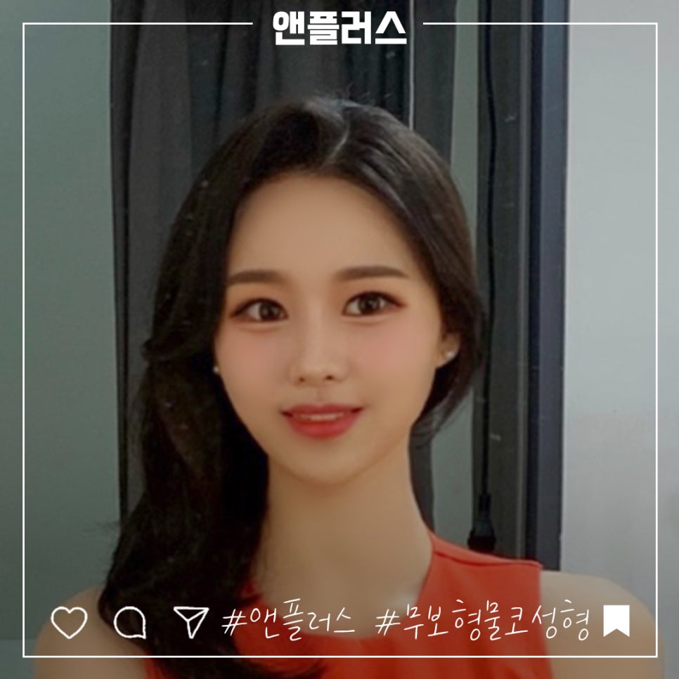 무보형물코수술 자연스러운 코 라인을 원한다면! 관련 이미지 2
