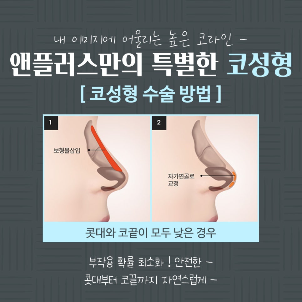 코수술전후 확실한 차이 관련 이미지 7