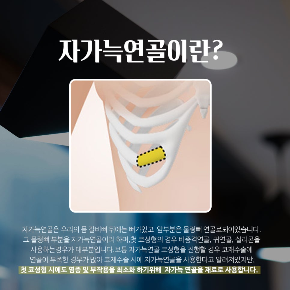 성형하기 힘든 코유형 관련 이미지 6