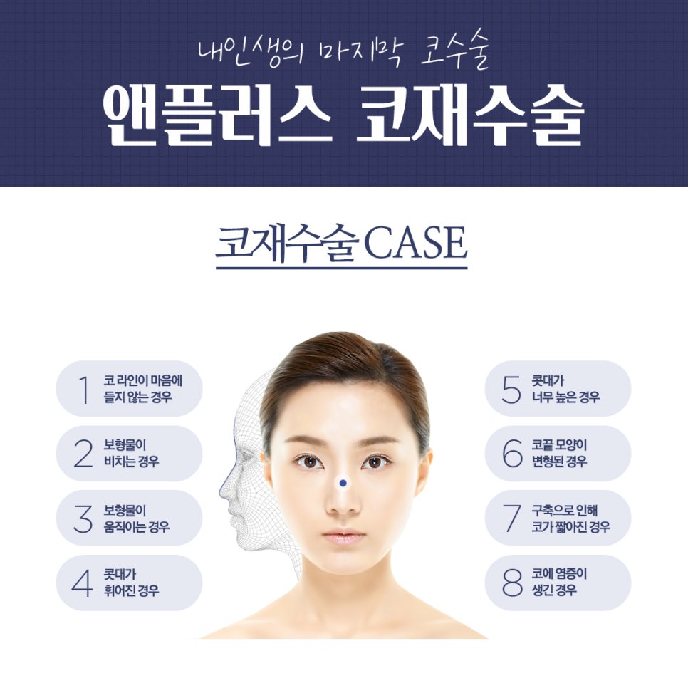 Complete Guide to Revision Rhinoplasty Recovery Period and Surgical Methods image 2