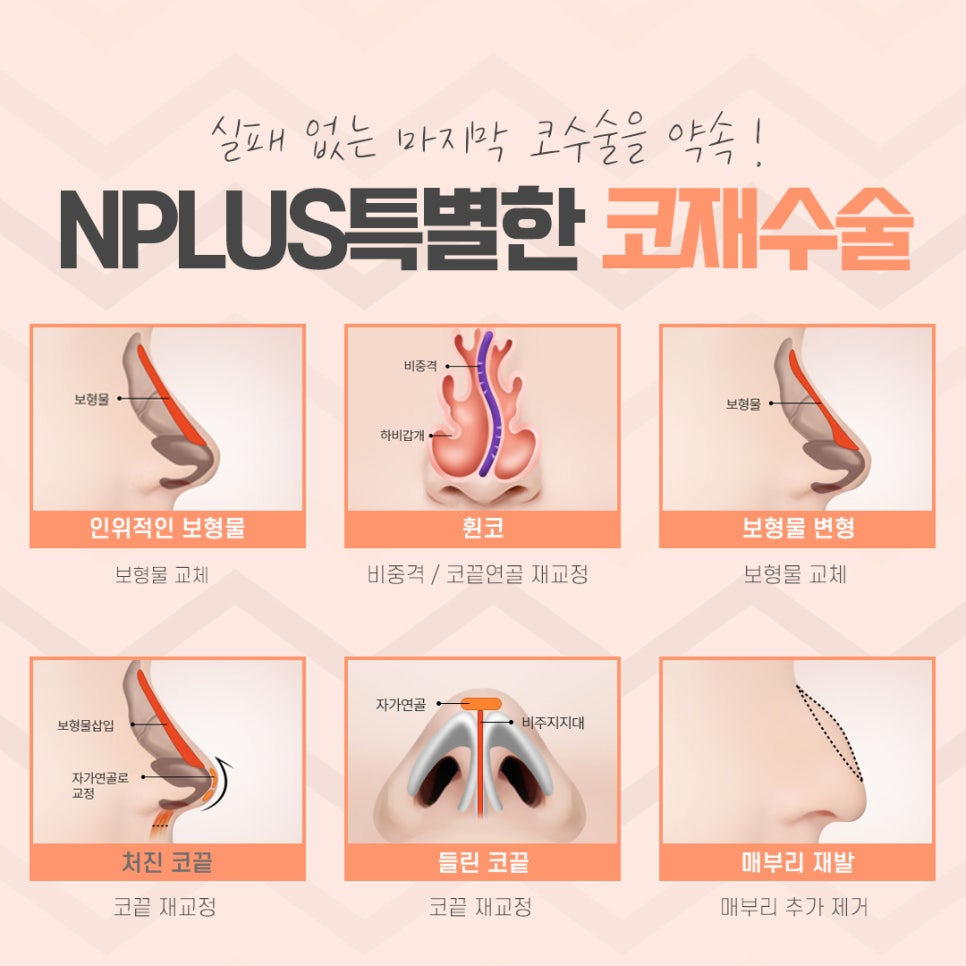 Carefully Looking Into Seoul Nose Revision Surgery image 7