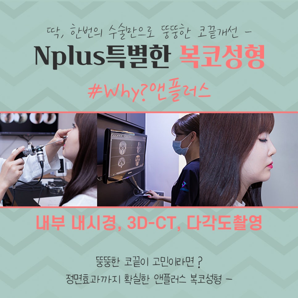 복코수술후기 세련된 인상으로 관련 이미지 13