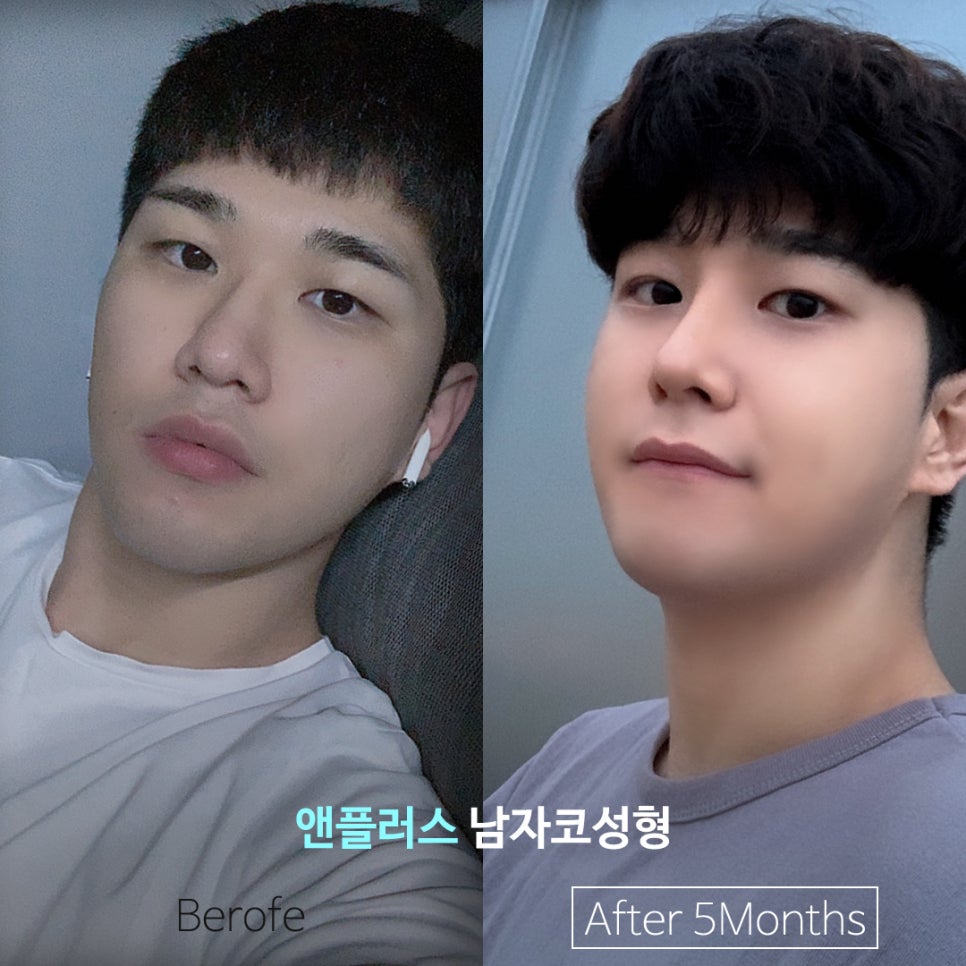남자연예인코 보고 본인에게 어울리는 남자코라인 찾기 관련 이미지 3