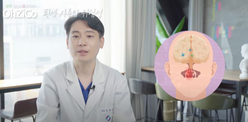 코수술 후 코냄새 원인과 해결 방법! 관련 이미지 19