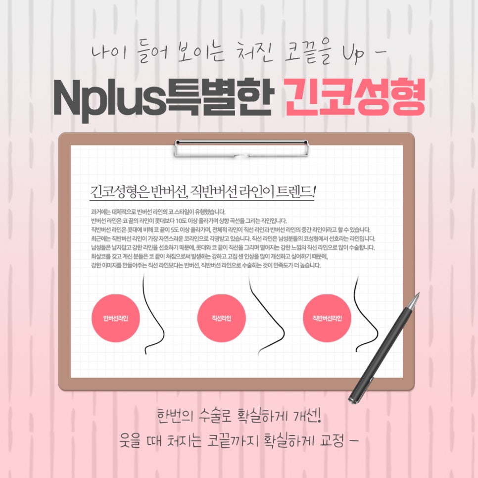 긴코성형 자연스럽게 교정하여 관련 이미지 12