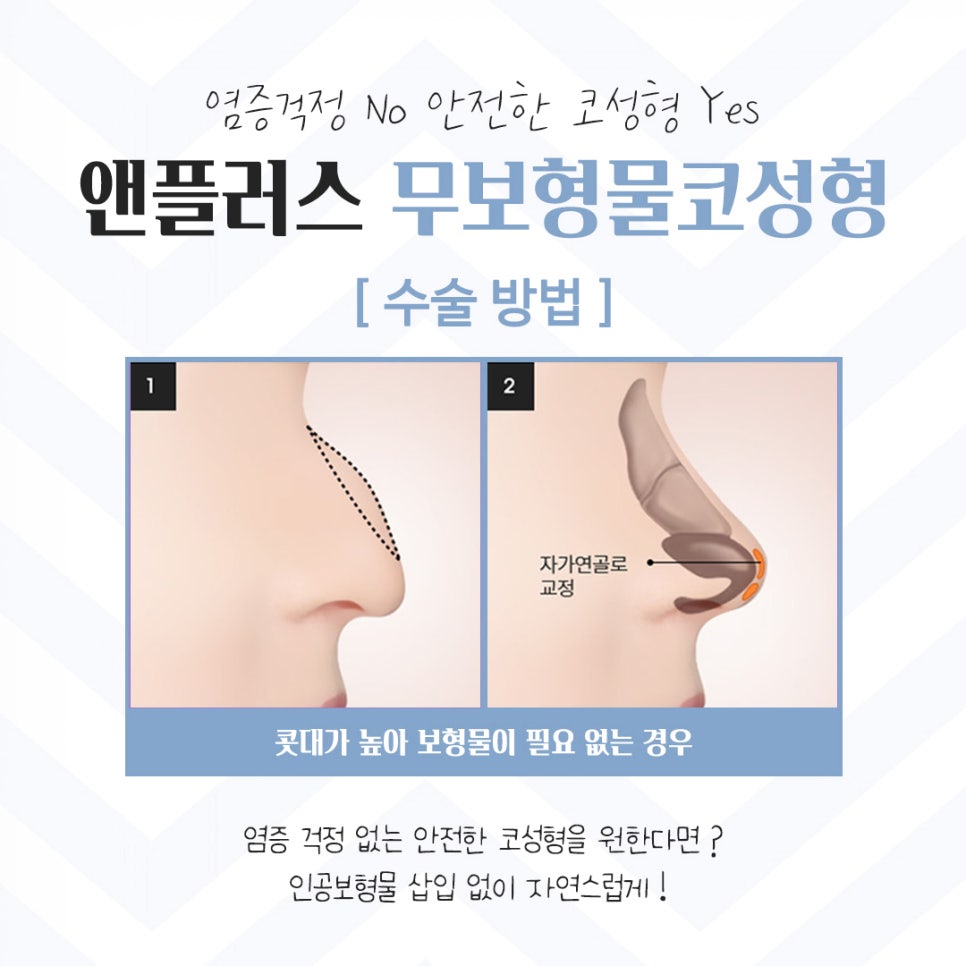 Detailed Information on Non-Implant Rhinoplasty image 8