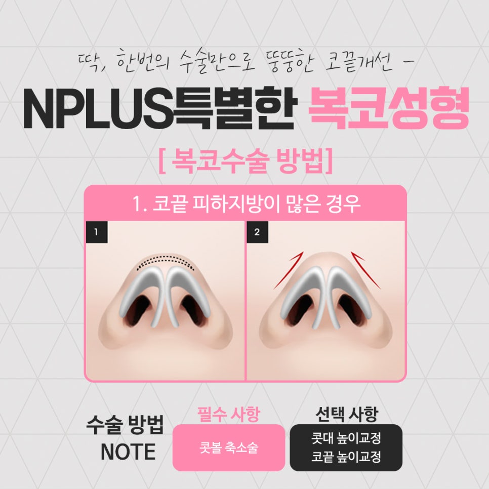 복코성형 세련된 이미지로 관련 이미지 9