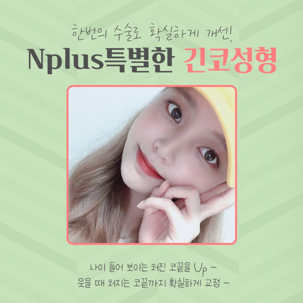 Long Nose Surgery: From Looking Older to Looking Younger image 2