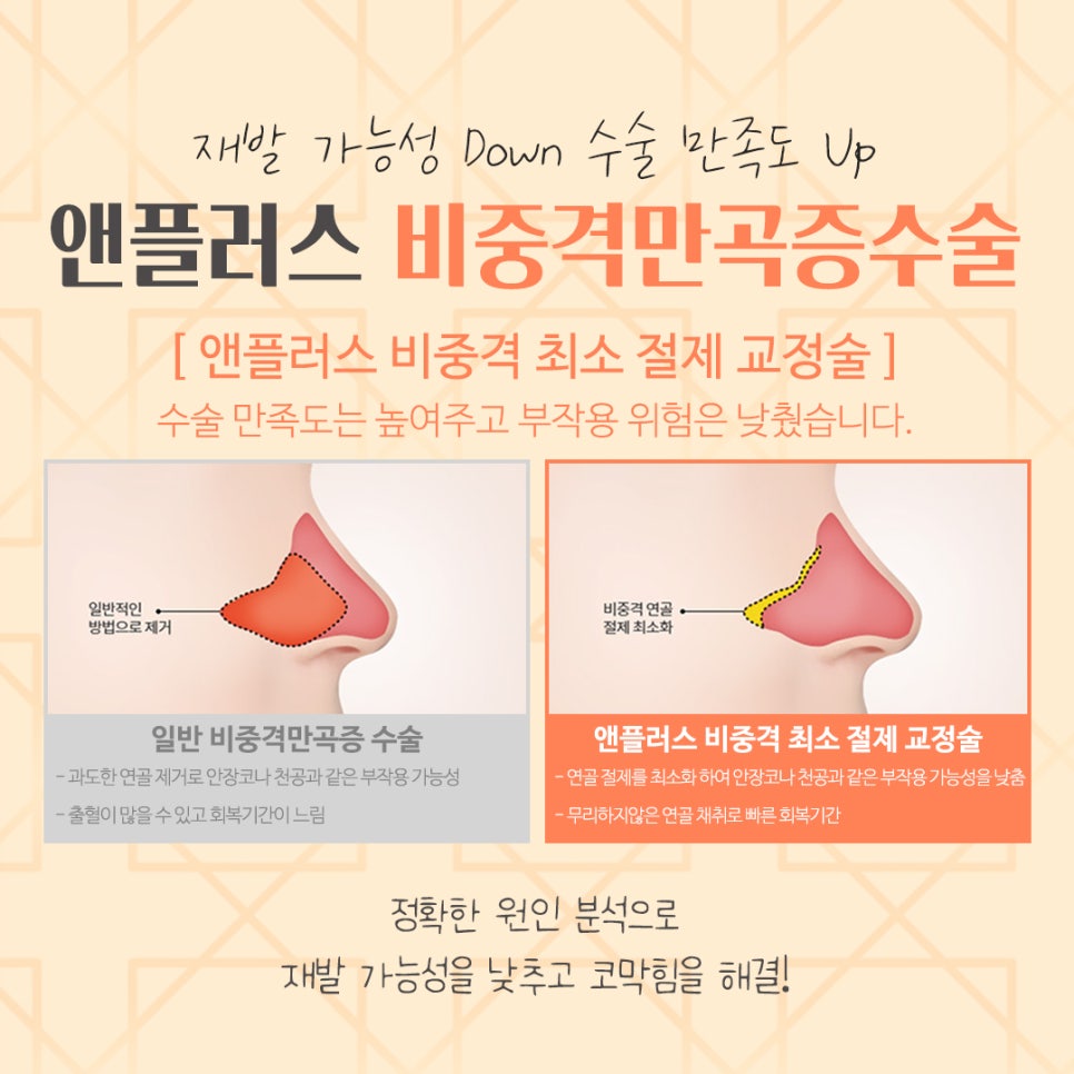 비중격만곡증수술후기 코 내부를 정확하게 파악해야 관련 이미지 11