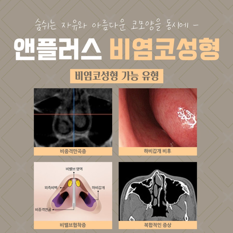 The Importance of Choosing a Rhinoplasty Review for Rhinitis image 4