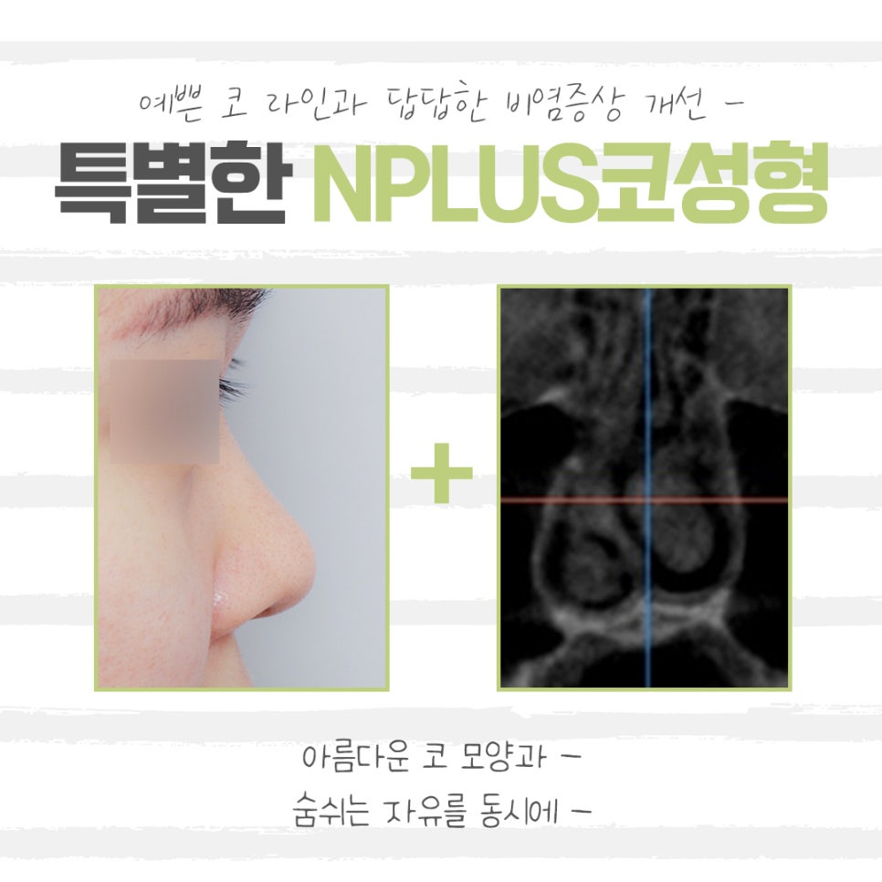 Learn About the Differences in Low Nose Rhinoplasty image 3