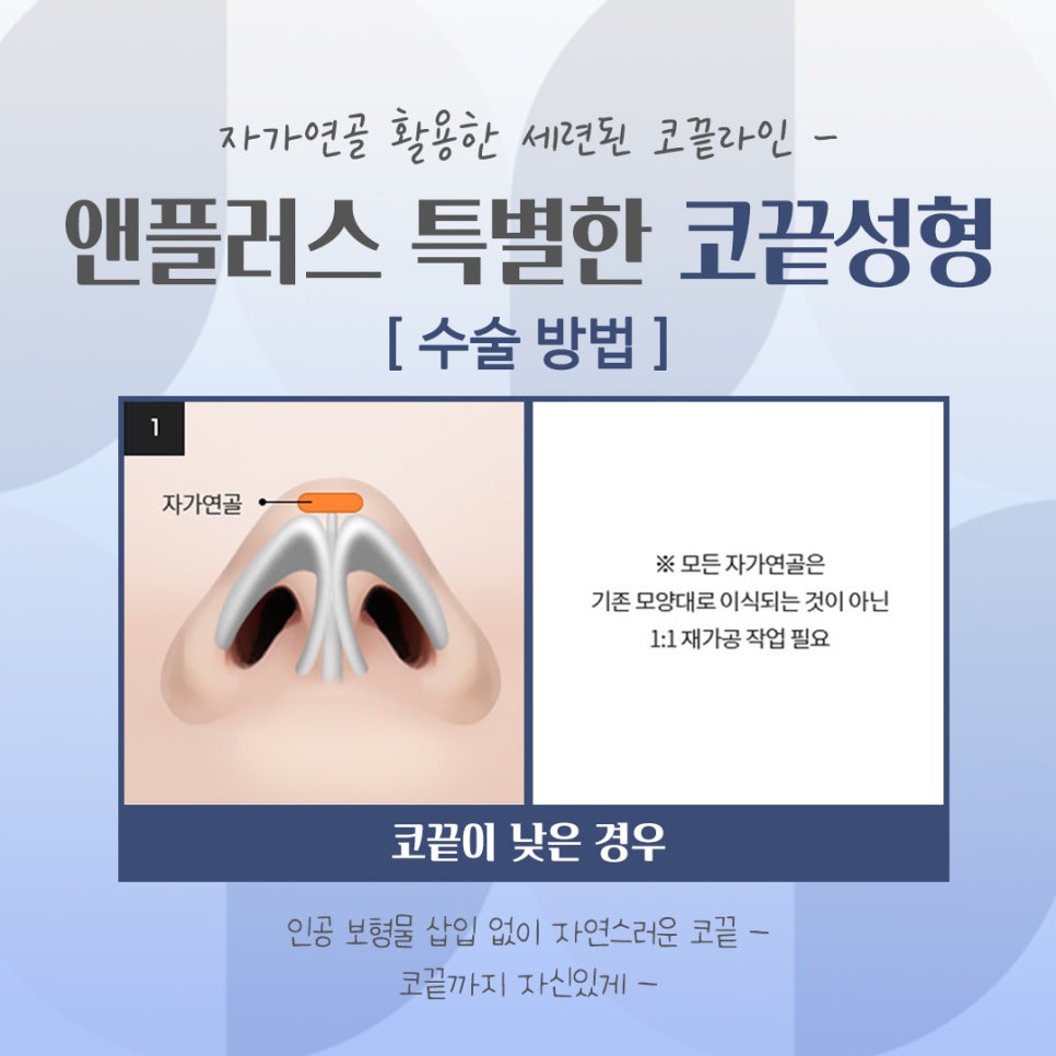 Looking Into Tip Rhinoplasty Reviews in Detail image 8