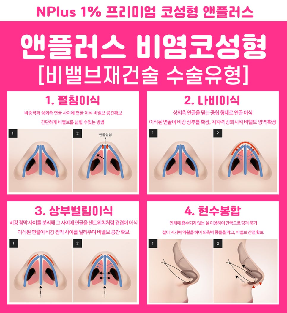 Septoplasty Surgery: A Careful Look From the Inside image 8