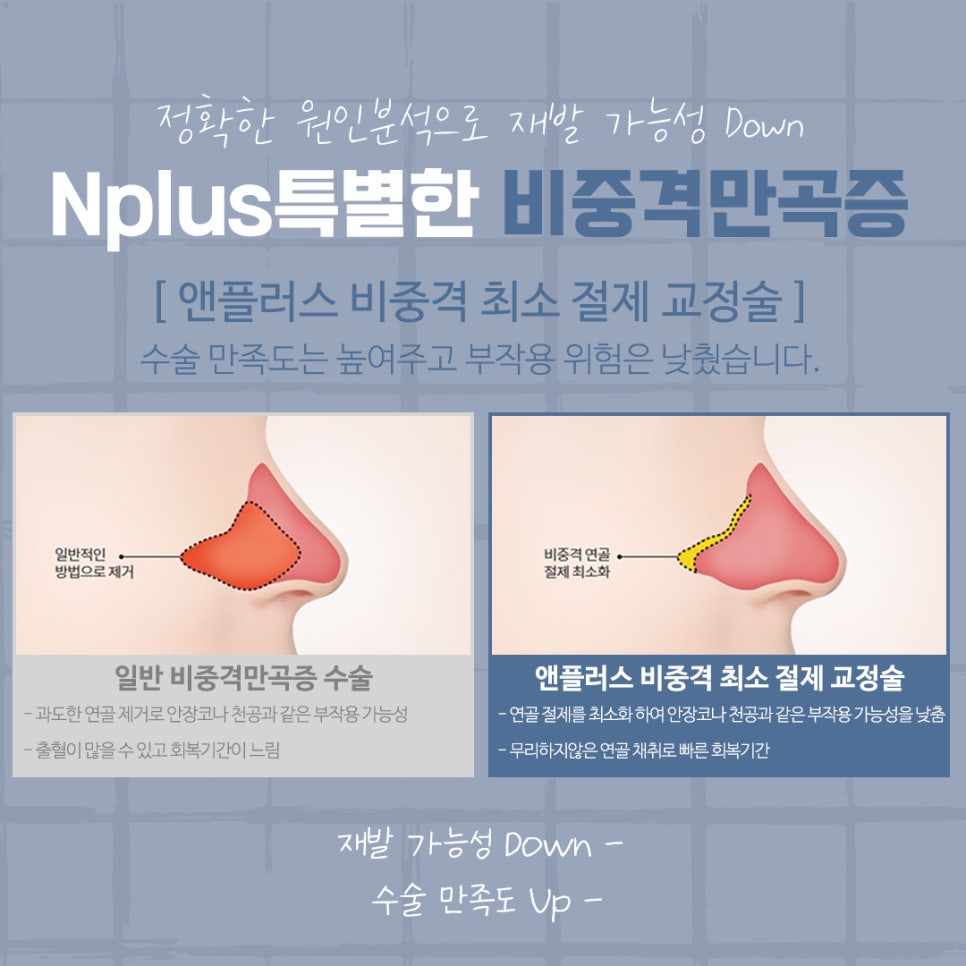 The Importance of Choosing a Septoplasty Review image 11