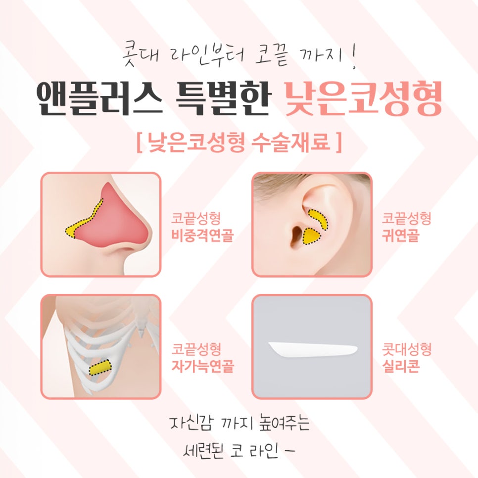 낮은코수술을 통해 날렵하고 세련된 이미지로 관련 이미지 9