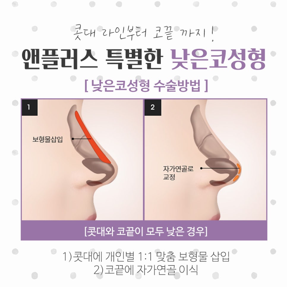 Checking Low Nose Surgery Reviews Too image 8