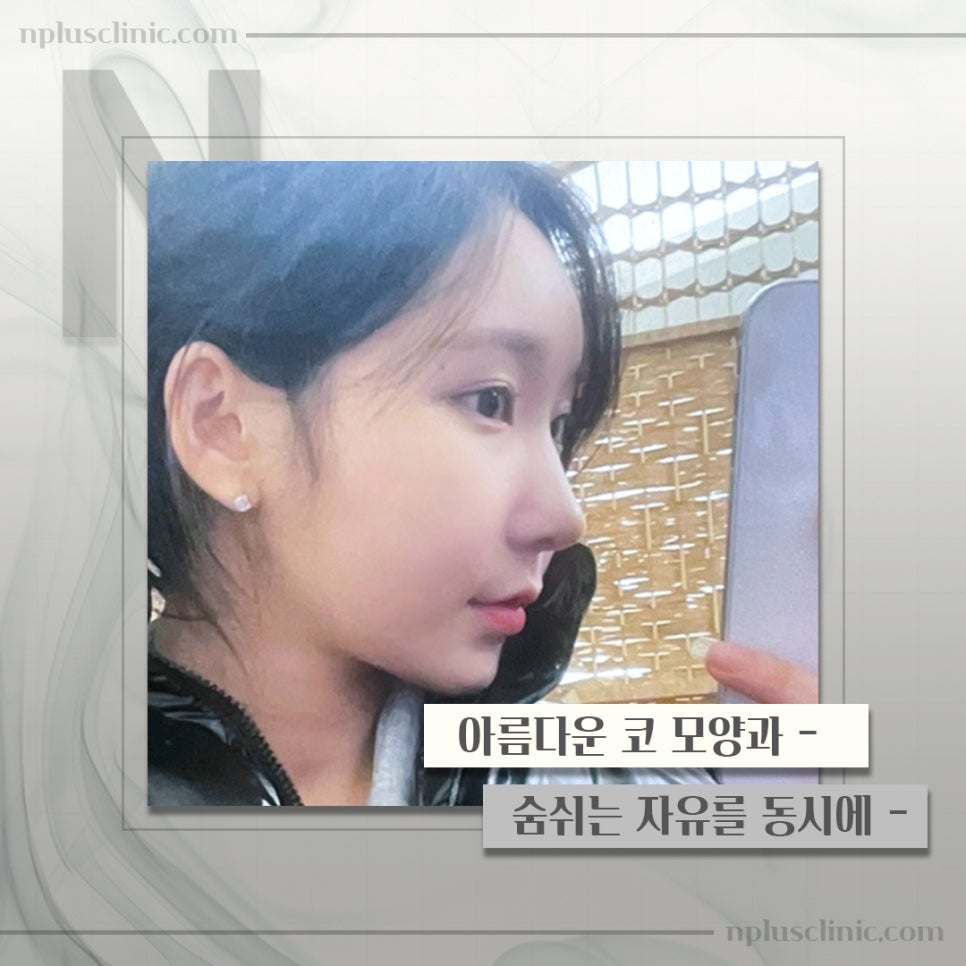 기능코성형실비에 대해 체크하고 관련 이미지 5