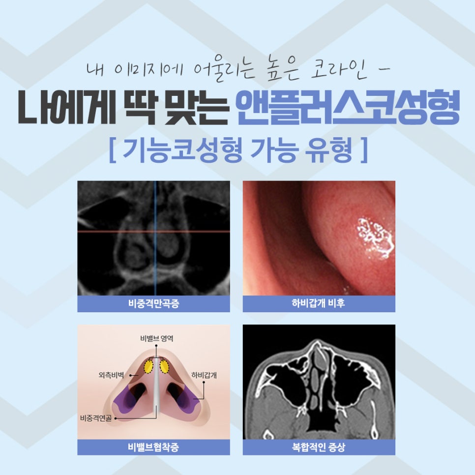 The Importance of Choosing Apgujeong Rhinoplasty image 12