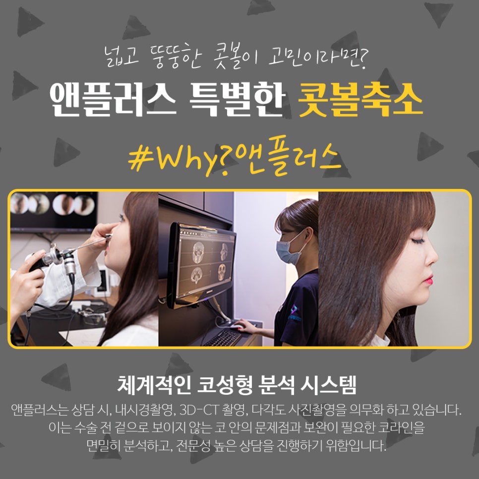 콧볼축소후기_넓은콧볼 고민해결 관련 이미지 8