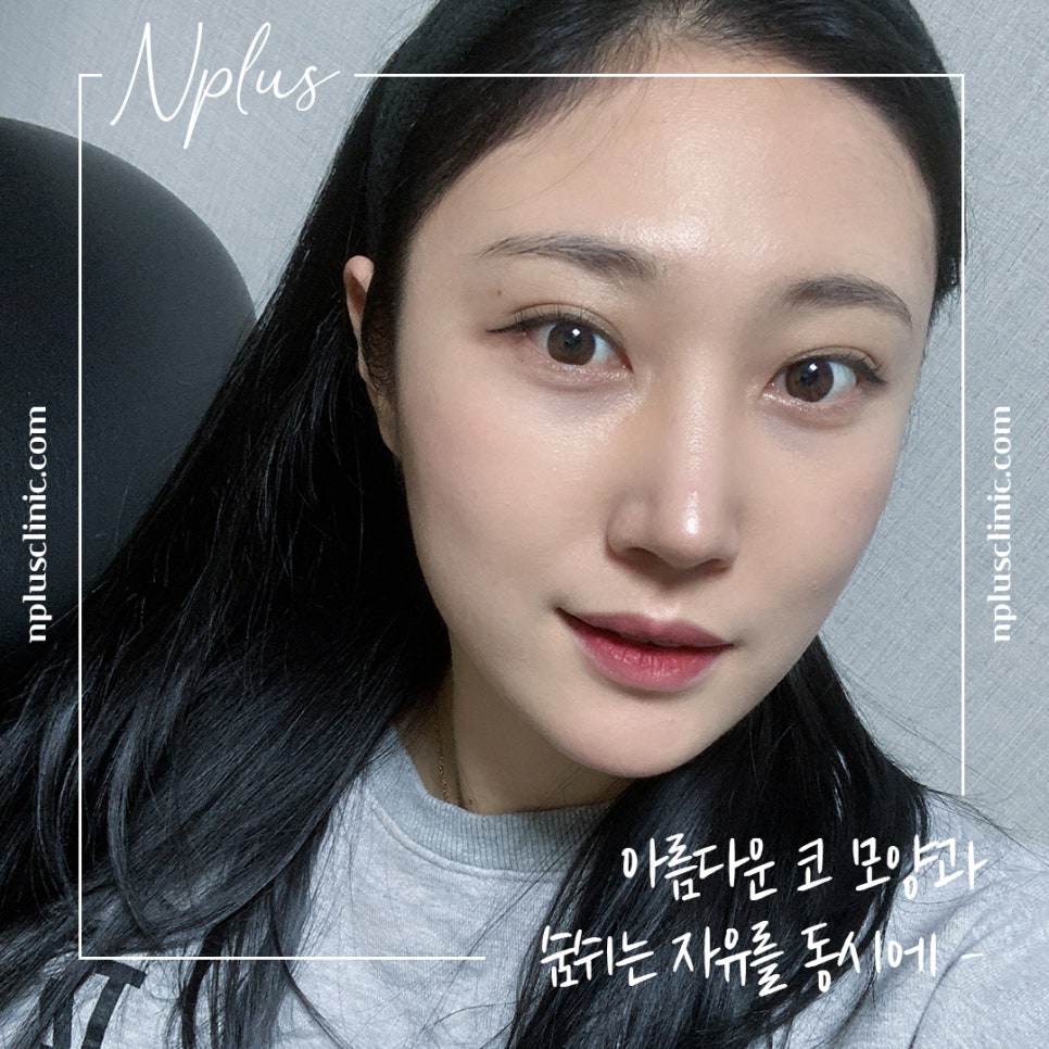 비염코성형실비 꼼꼼하게 체크하고 관련 이미지 2