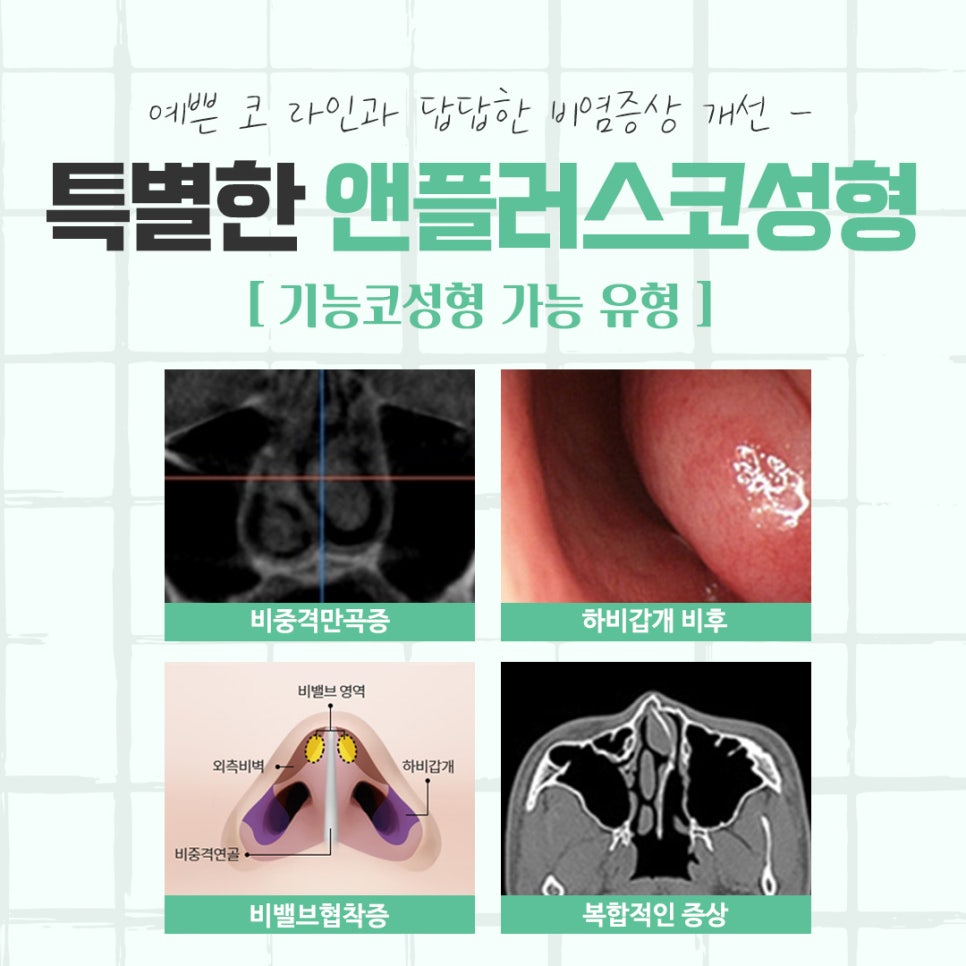 Learn in Detail About Nose Surgery in Gangnam image 4